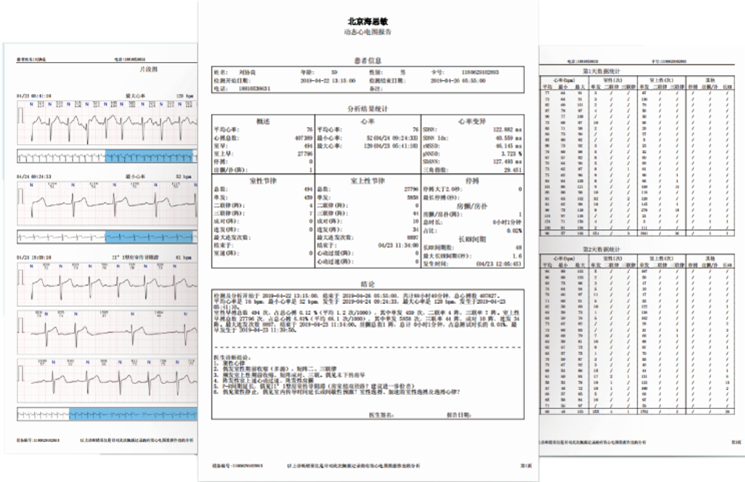 单导联长程连续心电图分析软件