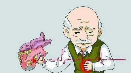 老年人护理心律失常时需要注意这些